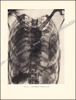 Afbeeldingen van Autour de l'autopsie d'une momie, Le Scribe royal Boutehamon